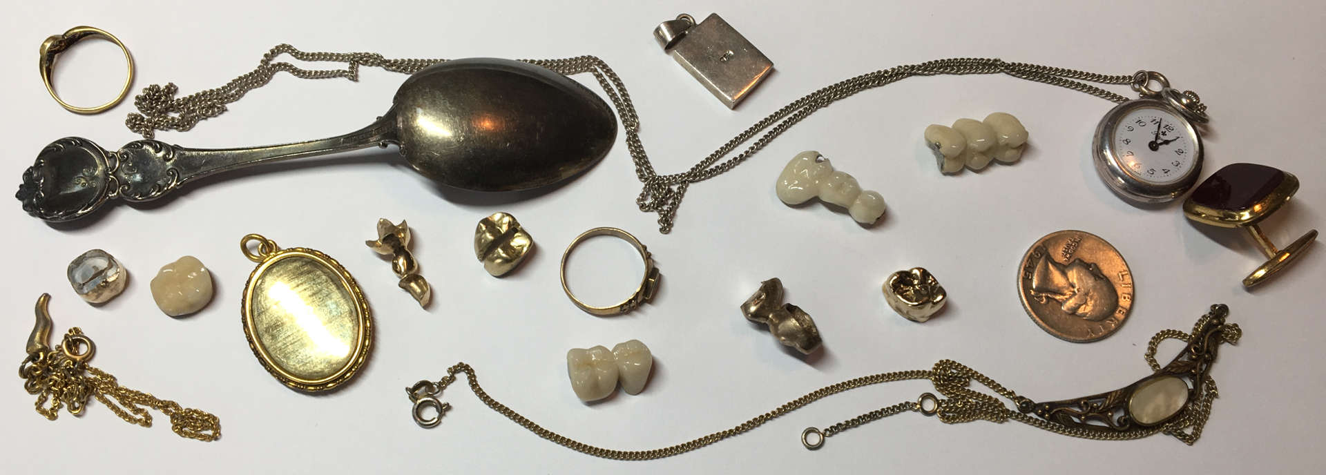 Goldzähne